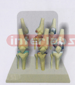 DESK- TYPE, DISEASE MOVABLE JOINTS MODEL WITH DESCRIPTION PLATE